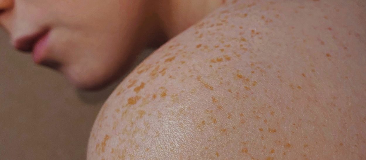 Materassi in lattice naturale e allergie: la verità sugli acari
